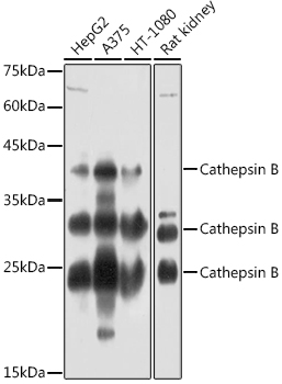 CTSB antibody