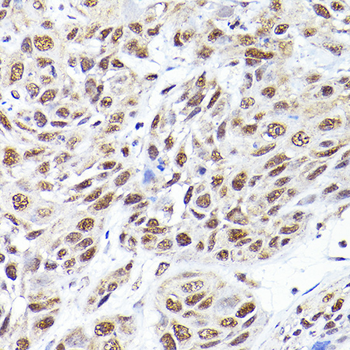 SEC14L2 antibody