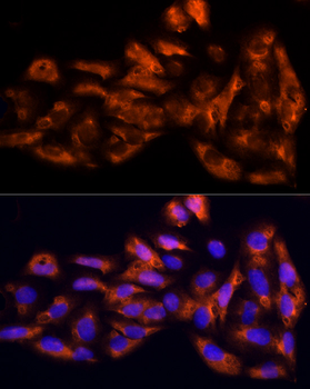 IL17C antibody