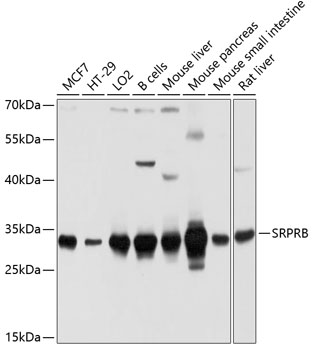 SRPRB antibody