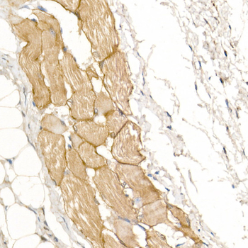 Dystrophin antibody