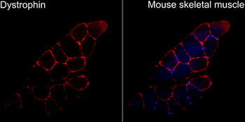 Dystrophin antibody