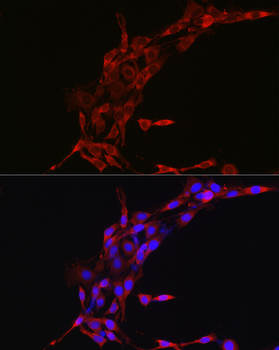 Cyclin B1 antibody