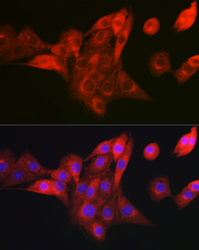 NDUFB8 antibody