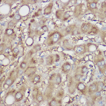 NDUFB8 antibody