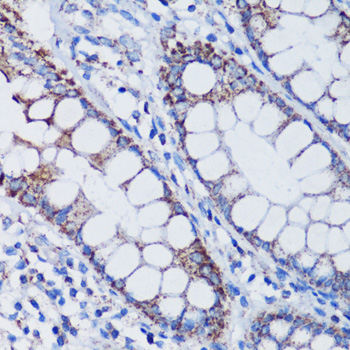 TFAM antibody