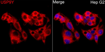 USP9Y antibody