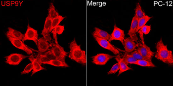 USP9Y antibody