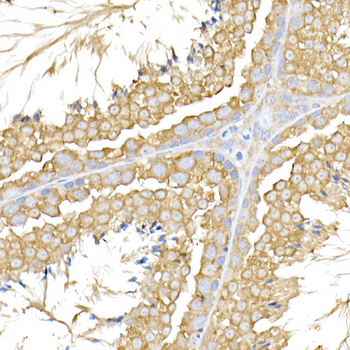 USP9Y antibody