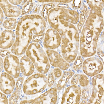 USP9Y antibody