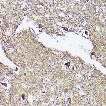 VDAC2 antibody