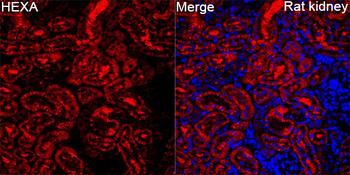 HEXA antibody