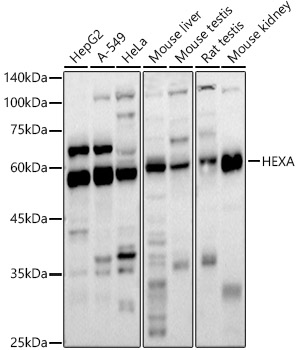 HEXA antibody