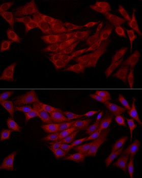 FABP5 antibody