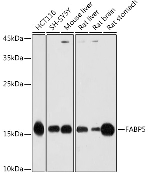 FABP5 antibody