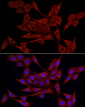 PDIA4 antibody