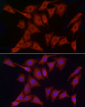 PDIA4 antibody