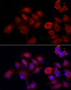 PDIA4 antibody