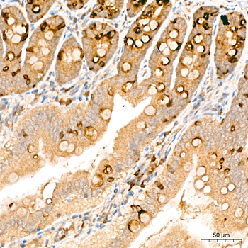 ACSL4 antibody