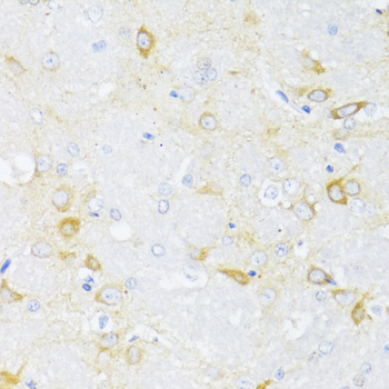 ARRB2 antibody