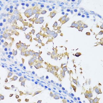 ARRB2 antibody