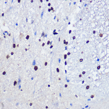 JMJD1C antibody