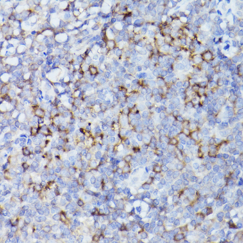 HLA-DQB1 antibody