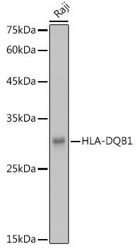 HLA-DQB1 antibody