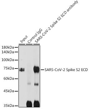 SARS-CoV-2 Spike S2 ECD antibody