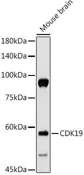 CDK19 antibody