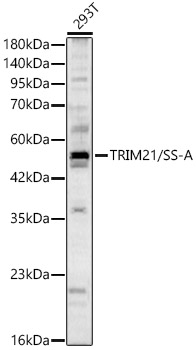 TRIM21 antibody