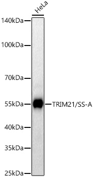 TRIM21 antibody