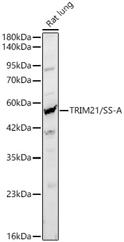 TRIM21 antibody