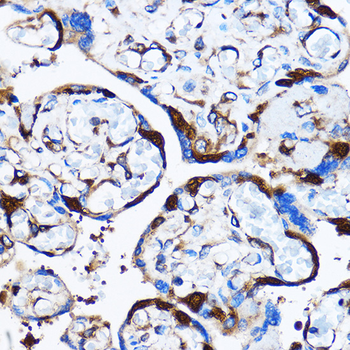 p38 MAPK antibody