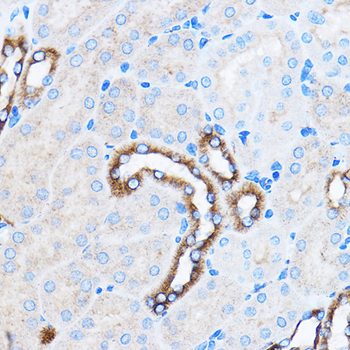 p38 MAPK antibody