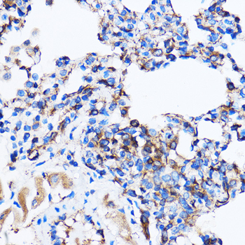 p38 MAPK antibody