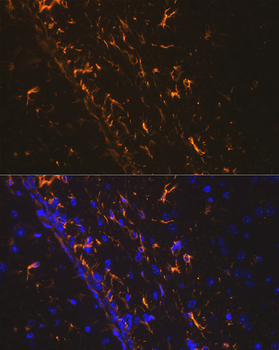 GFAP antibody