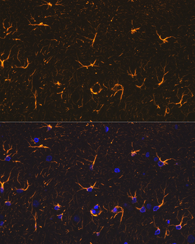 GFAP antibody