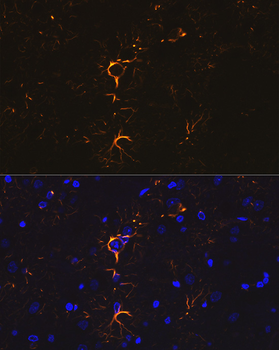 GFAP antibody