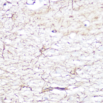 GFAP antibody