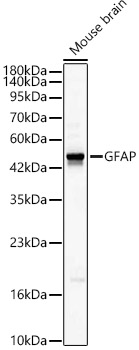 GFAP antibody