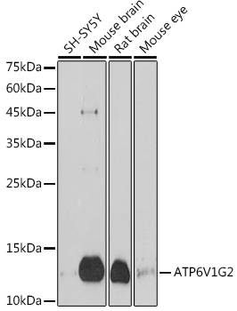 ATP6V1G2 antibody