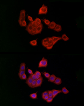 UBE2C antibody