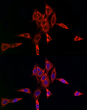 UBE2C antibody