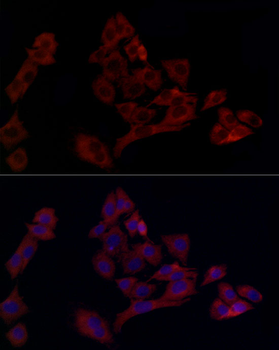 UBE2C antibody