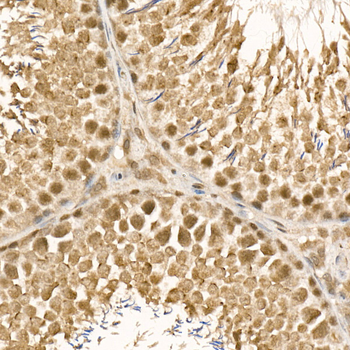 UBE2C antibody