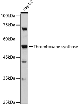 Thromboxane synthase antibody