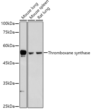 Thromboxane synthase antibody