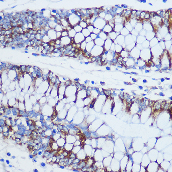 TOM20 antibody