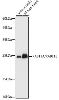 RAB11A/RAB11B antibody